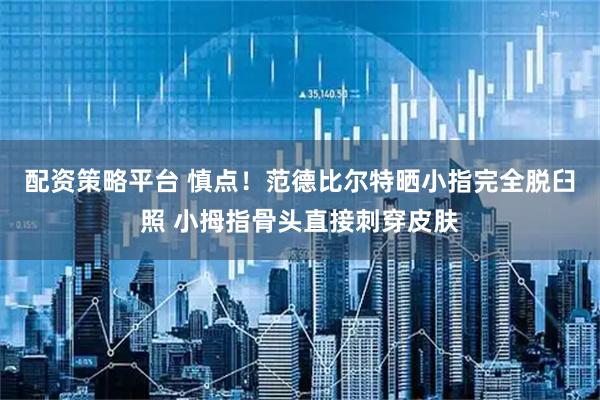 配资策略平台 慎点！范德比尔特晒小指完全脱臼照 小拇指骨头直接刺穿皮肤
